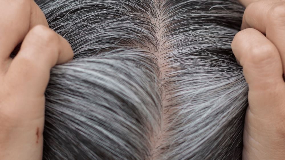 What Age Is Premature Gray Hair